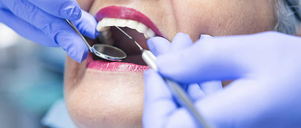 Best Emergency Root Canal Therapy in Canton, MO